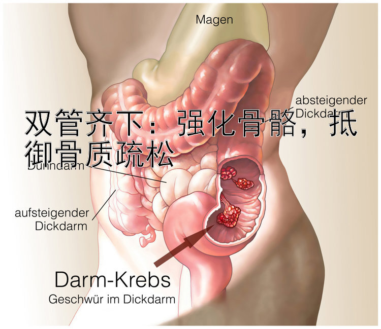 双管齐下：强化骨骼，抵御骨质疏松