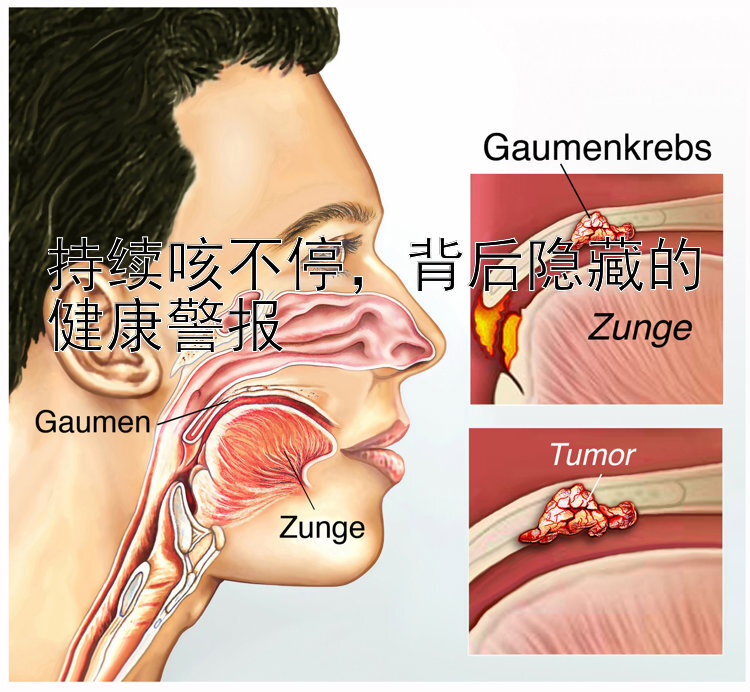 持续咳不停，背后隐藏的健康警报