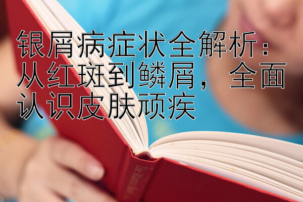 银屑病症状全解析：从红斑到鳞屑，全面认识皮肤顽疾