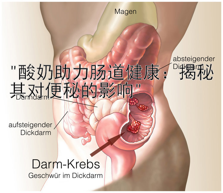 酸奶助力肠道健康：揭秘其对便秘的影响