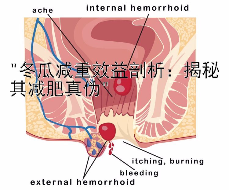 冬瓜减重效益剖析：揭秘其减肥真伪