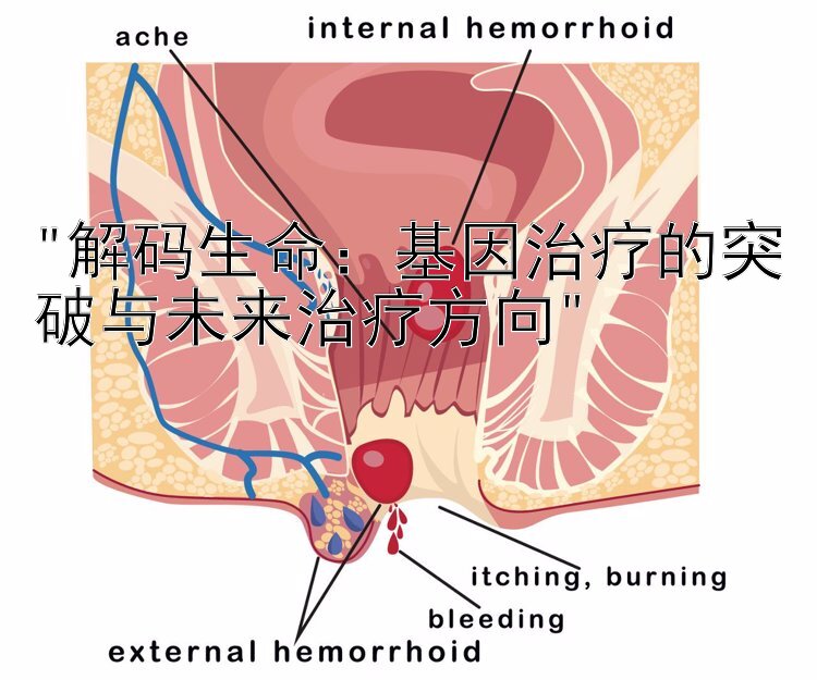 解码生命：基因治疗的突破与未来治疗方向