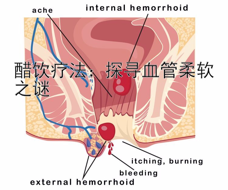 醋饮疗法：探寻血管柔软之谜