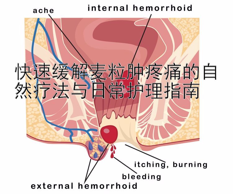 快速缓解麦粒肿疼痛的自然疗法与日常护理指南