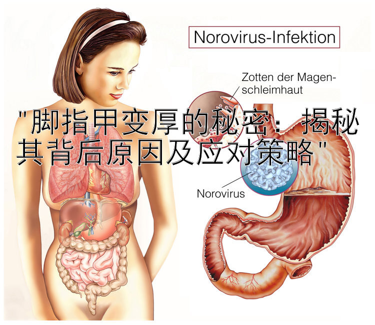 脚指甲变厚的秘密：揭秘其背后原因及应对策略