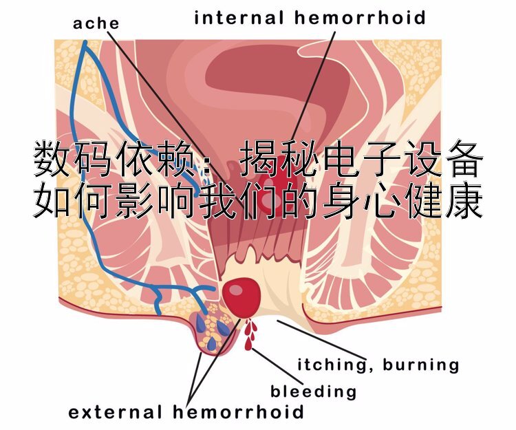 数码依赖：揭秘电子设备如何影响我们的身心健康