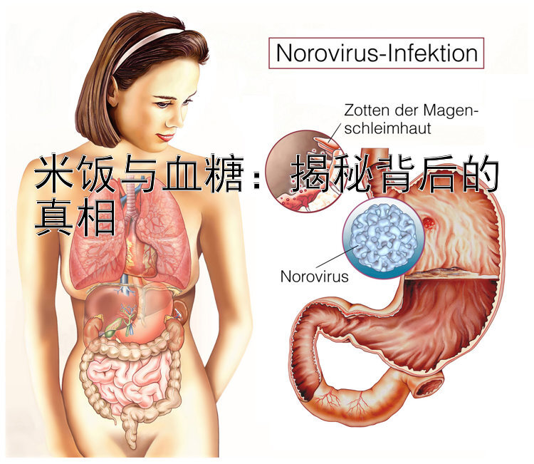 米饭与血糖：揭秘背后的真相