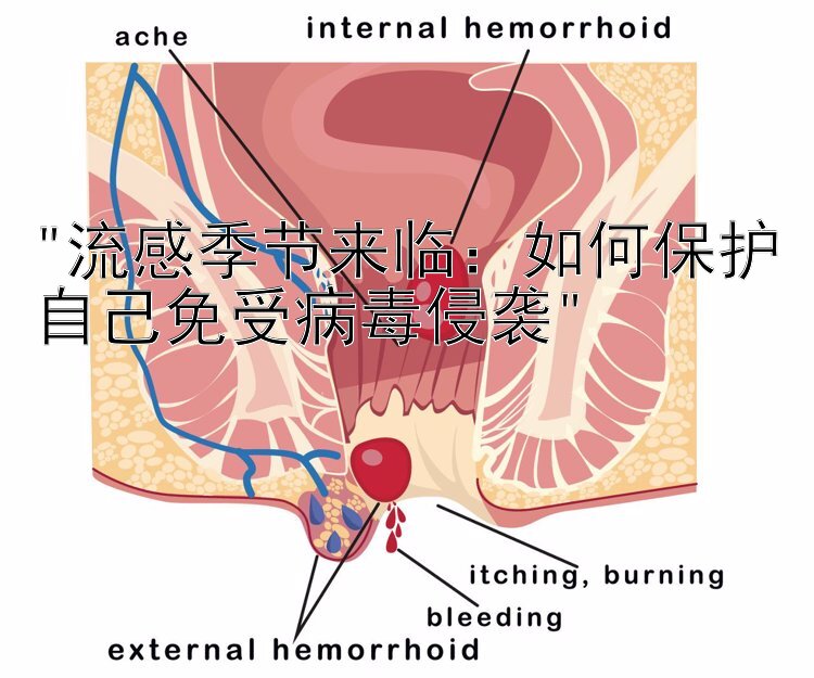 流感季节来临：如何保护自己免受病毒侵袭