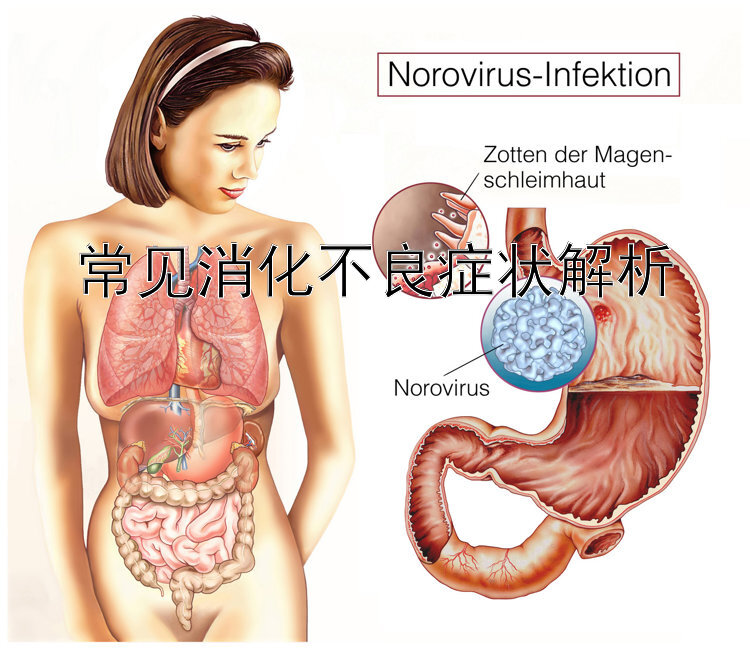 常见消化不良症状解析