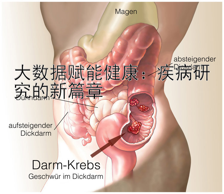 大数据赋能健康：疾病研究的新篇章