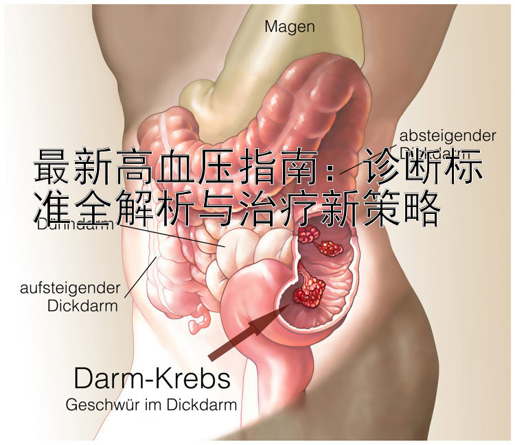 最新高血压指南：诊断标准全解析与治疗新策略