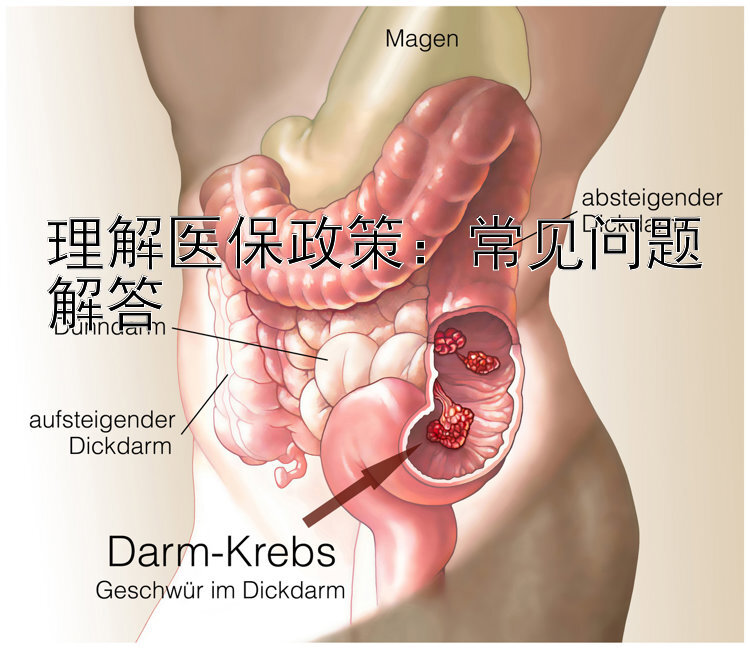 理解医保政策：常见问题解答