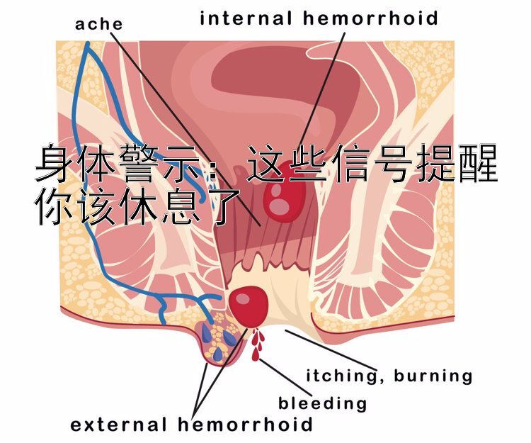 身体警示：这些信号提醒你该休息了