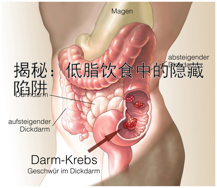 揭秘：低脂饮食中的隐藏陷阱