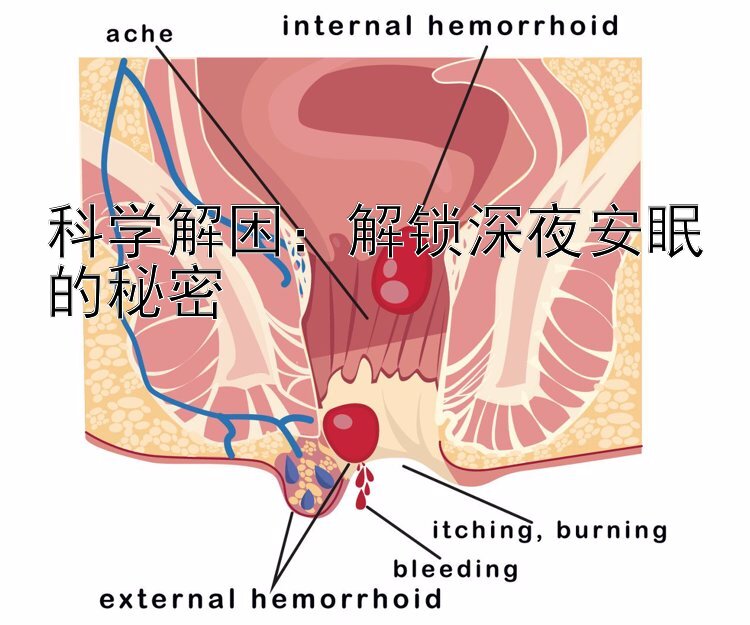 科学解困：解锁深夜安眠的秘密