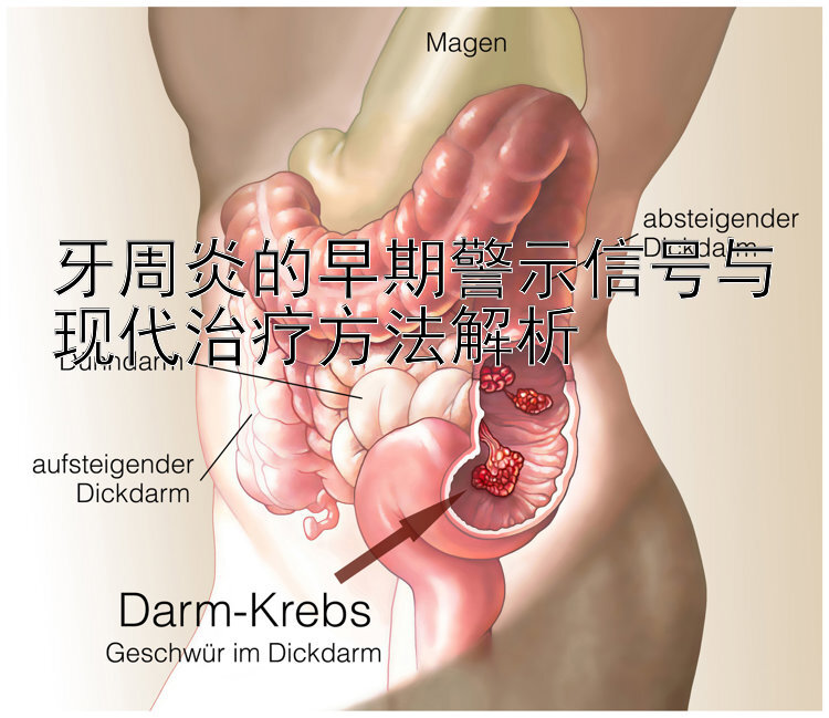 牙周炎的早期警示信号与现代治疗方法解析