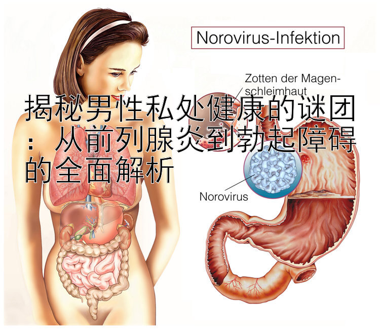 揭秘男性私处健康的谜团：从前列腺炎到勃起障碍的全面解析