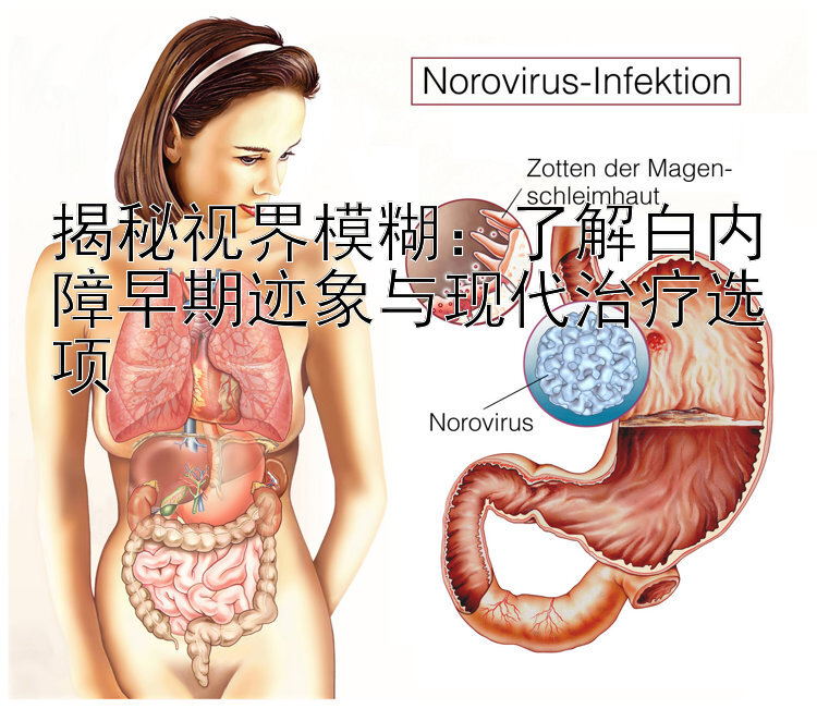 揭秘视界模糊：了解白内障早期迹象与现代治疗选项