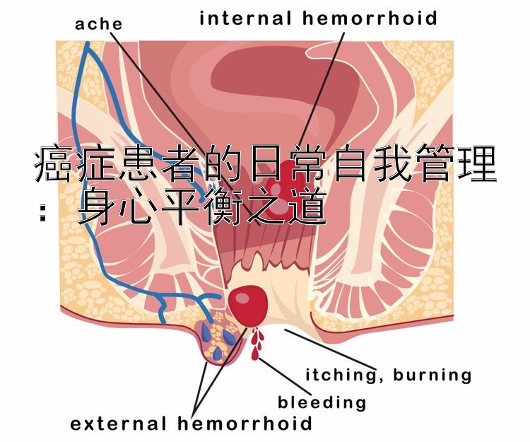 癌症患者的日常自我管理：身心平衡之道