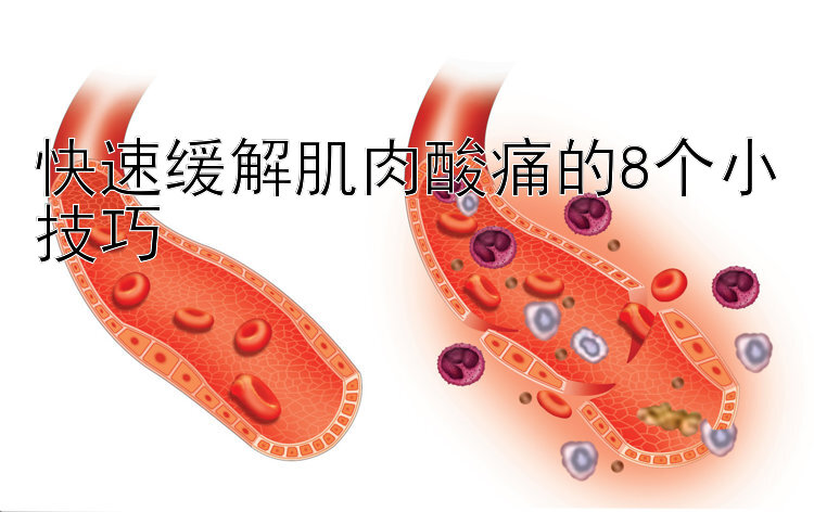 快速缓解肌肉酸痛的8个小技巧