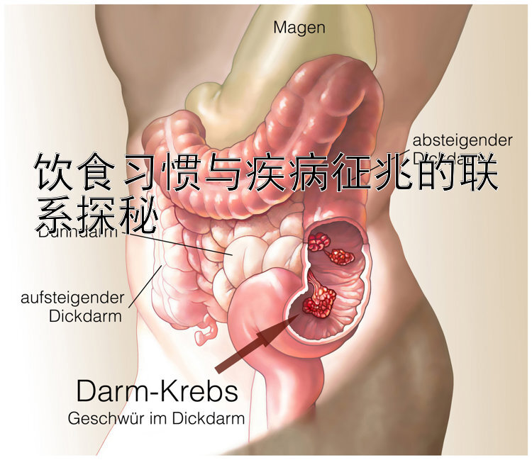 饮食习惯与疾病征兆的联系探秘