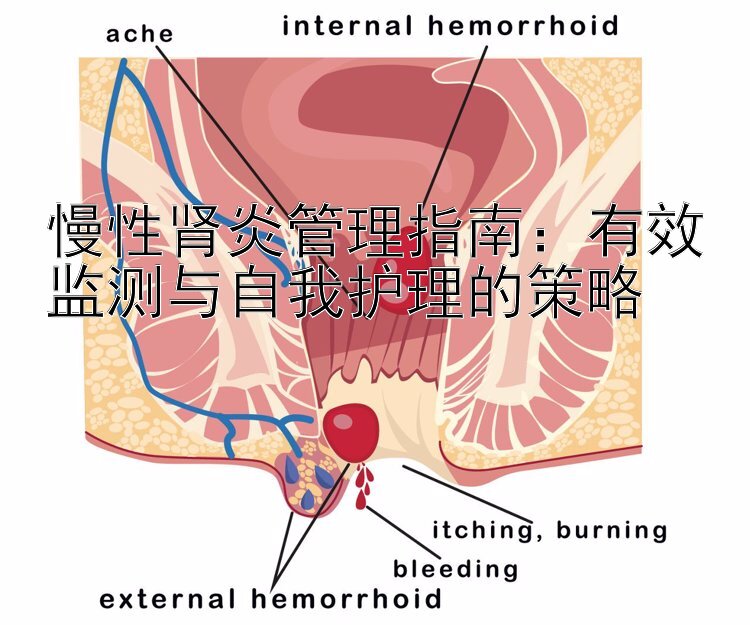 慢性肾炎管理指南：有效监测与自我护理的策略