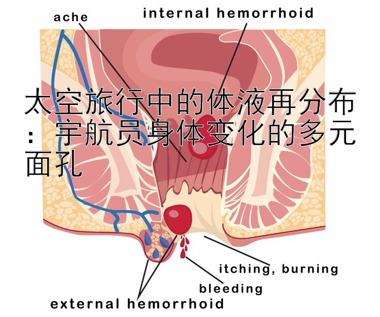 太空旅行中的体液再分布：宇航员身体变化的多元面孔