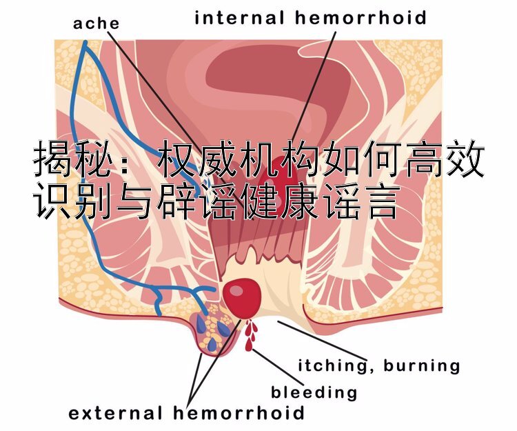 揭秘：权威机构如何高效识别与辟谣健康谣言