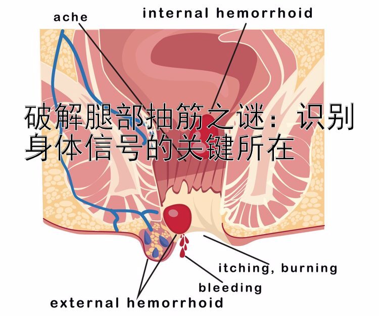 破解腿部抽筋之谜：识别身体信号的关键所在