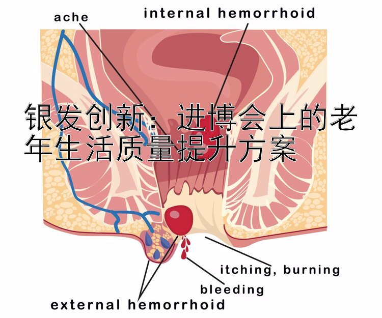 银发创新：进博会上的老年生活质量提升方案