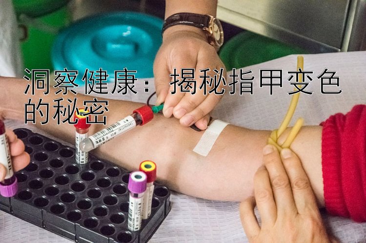 洞察健康：揭秘指甲变色的秘密