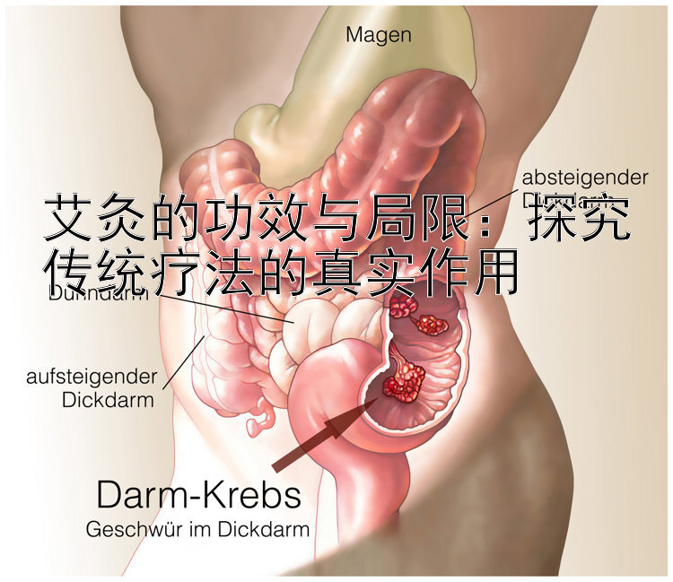 艾灸的功效与局限：探究传统疗法的真实作用