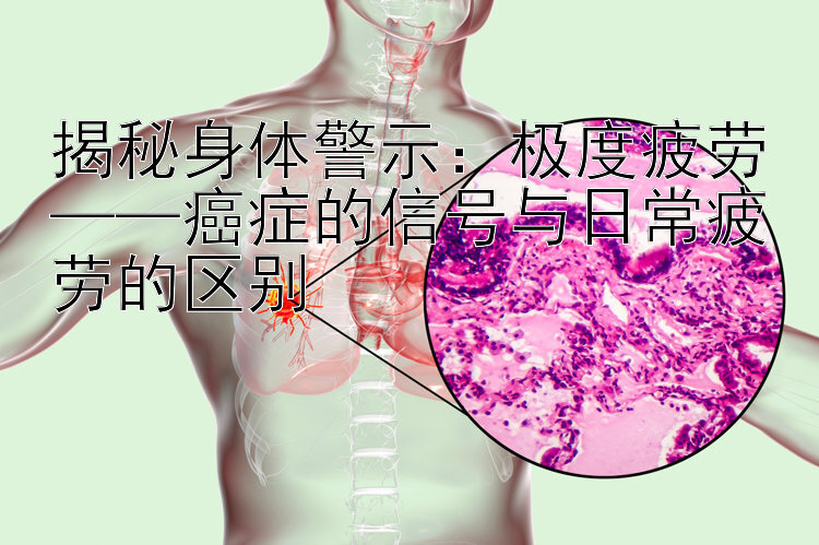 揭秘身体警示：极度疲劳——癌症的信号与日常疲劳的区别