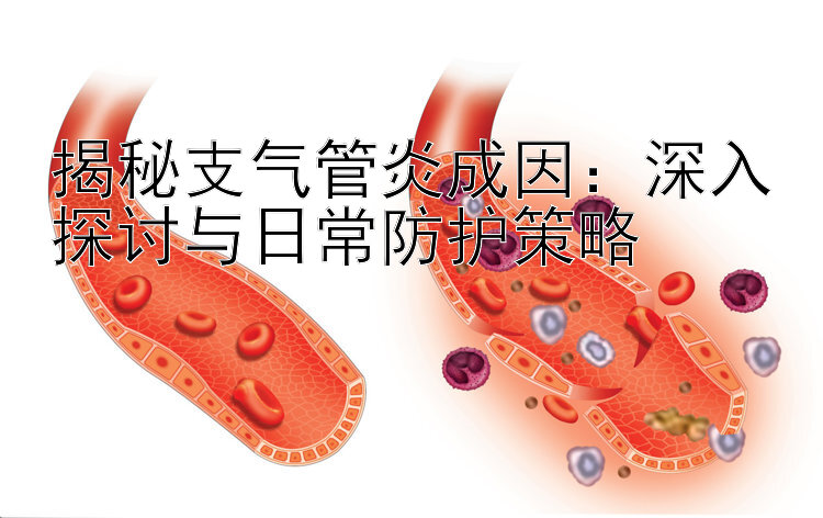 揭秘支气管炎成因：深入探讨与日常防护策略