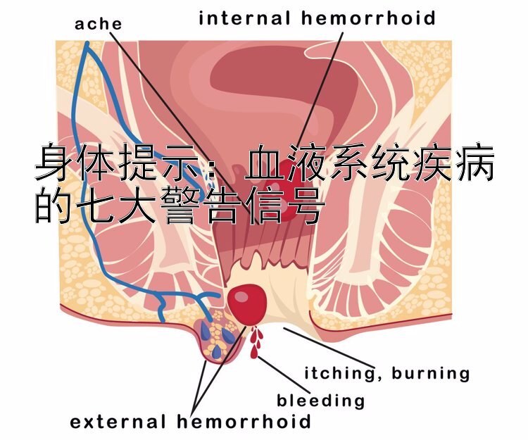 身体提示：血液系统疾病的七大警告信号