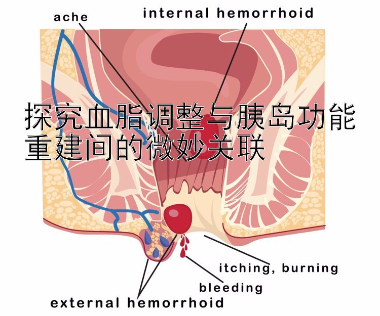 探究血脂调整与胰岛功能重建间的微妙关联