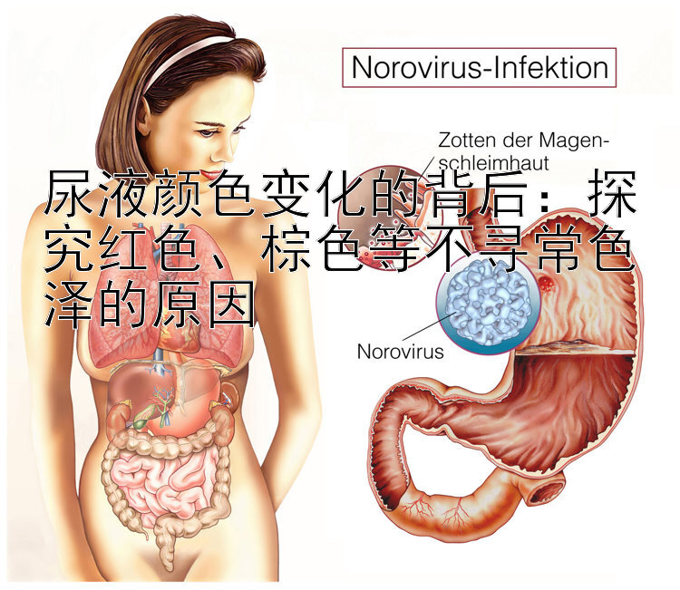 尿液颜色变化的背后：探究红色、棕色等不寻常色泽的原因