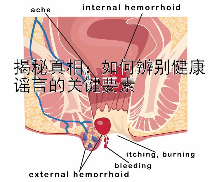 揭秘真相：如何辨别健康谣言的关键要素