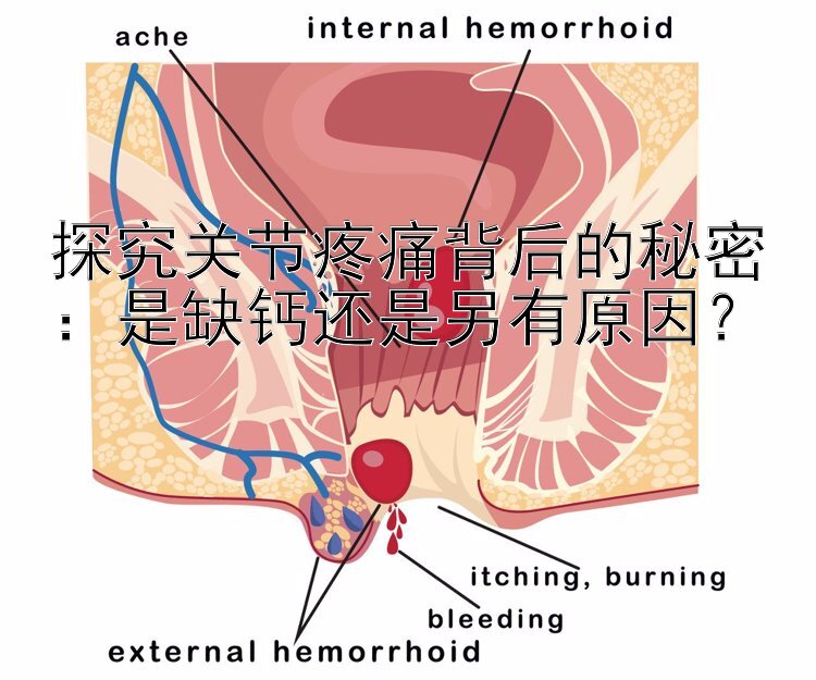 探究关节疼痛背后的秘密：是缺钙还是另有原因？