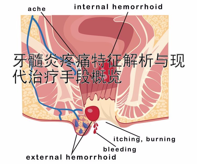 牙髓炎疼痛特征解析与现代治疗手段概览