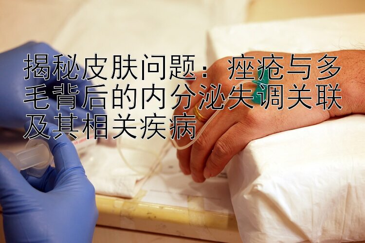 揭秘皮肤问题：痤疮与多毛背后的内分泌失调关联及其相关疾病