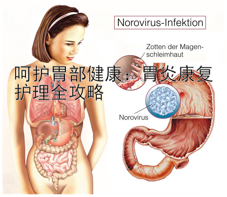 呵护胃部健康：胃炎康复护理全攻略