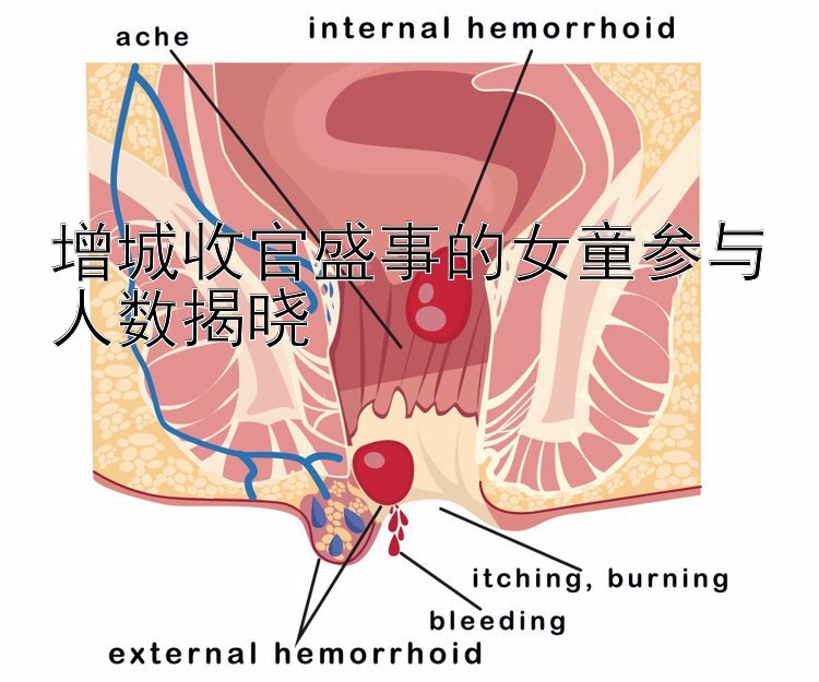 增城收官盛事的女童参与人数揭晓