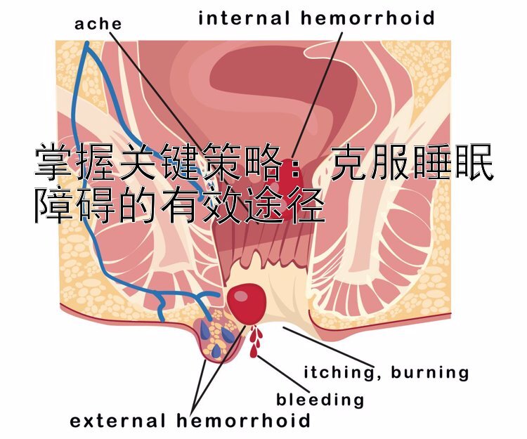 掌握关键策略：克服睡眠障碍的有效途径