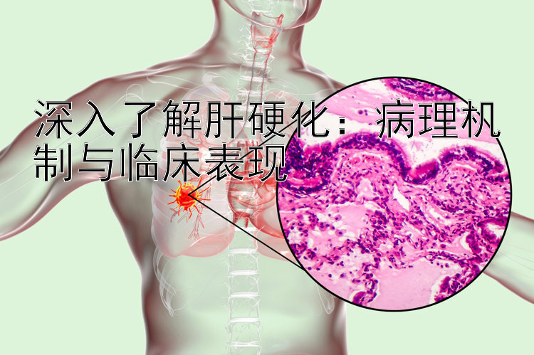 深入了解肝硬化：病理机制与临床表现