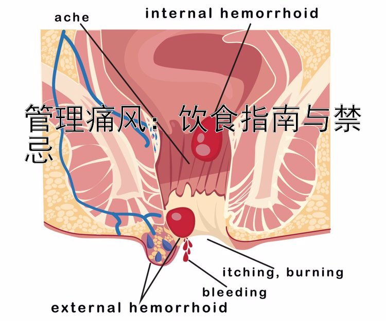 管理痛风：饮食指南与禁忌