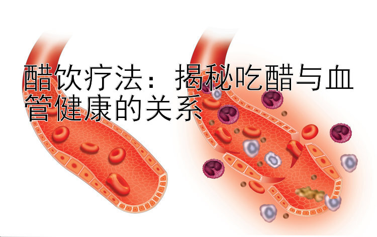 醋饮疗法：揭秘吃醋与血管健康的关系