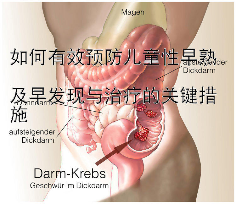 如何有效预防儿童性早熟  
及早发现与治疗的关键措施