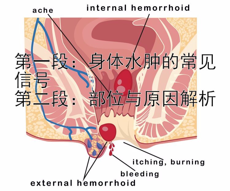 第一段：身体水肿的常见信号  
第二段：部位与原因解析