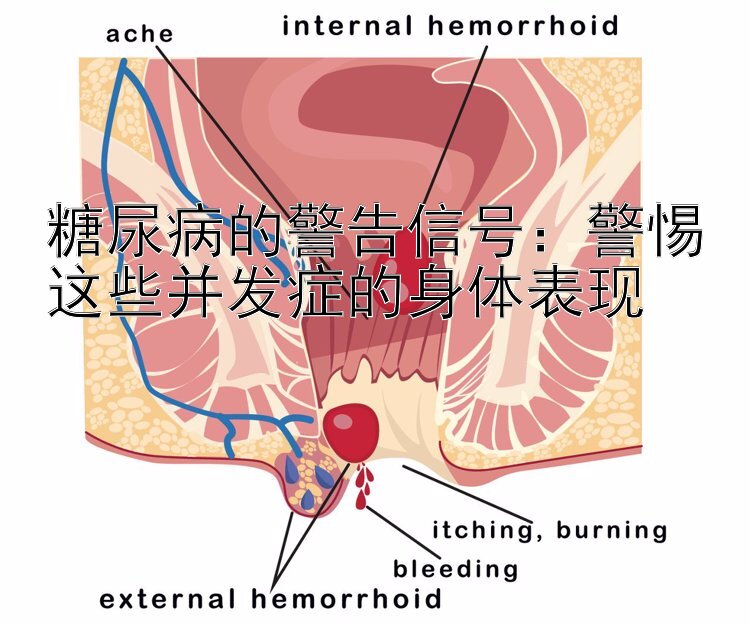 糖尿病的警告信号：警惕这些并发症的身体表现